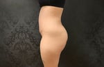 Tummy Tuck